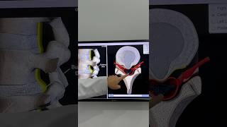 Cùng các bệnh nhân gặp BS Luke tại ACC Tản Đà #shorts #phòngkhámacc #chiropractic #thoatvidiadem