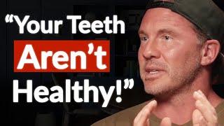 "Fix This Early On!" - How Root Canals Decrease Your Lifespan & Cause Disease | Dr Dominik Nischwitz