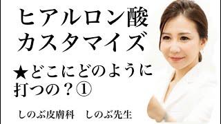 ①ヒアルロン酸注射で良く聞かれる質問は、「どこにどのように打ちますか？」ということです。ご説明致しますね。その１