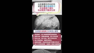 元和雅整形外科診所全新引進一低溫電漿刀隆乳、低溫電漿刀腹部拉皮