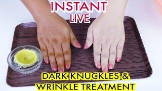 How To Whiten Dark Knuckles And Treat Wrinkles ,Homemade Sun Tan Removal Remedy| SuperPrincessjo