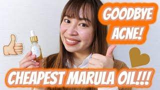 CHEAPEST MARULA OIL | IT CURED MY ACNE?!