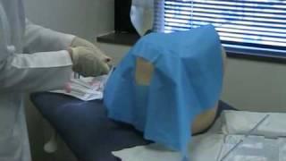 Lumbar Puncture Procedural Video [Tulane Medicine]