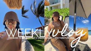 Weekly Vlog| Girls Trip to Cancun Mexico + I got a chemical burn + new furniture & more| chelsiejayy