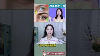 【眼部瑜伽】改善眼皮下垂 【Fix Droopy Eyelids】