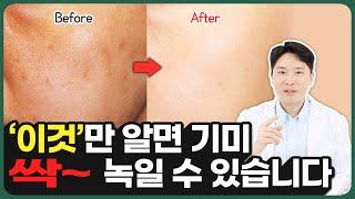 얼굴에 자리잡은 기미를 확실하게 없애는 방법