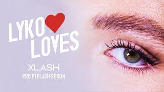 Lyko Loves - Xlash