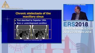 ERS London 2018, P Eloy, Silent Sinus Syndrome