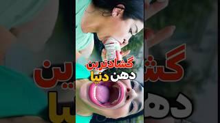 دهن این آدم رو دیدین؟#shortvideo#shorts