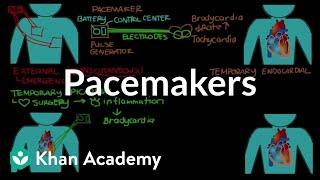 Pacemakers | Circulatory System and Disease | NCLEX-RN | Khan Academy