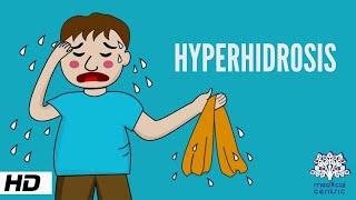Hyperhidrosis, Causes, Signs and Symptoms, Diagnosis and Treatment.