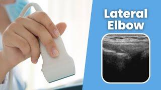 Lateral Elbow - MSKUS - How to scan the Lateral Elbow - 2 minute tuesday