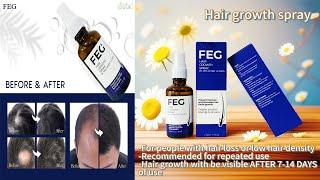 50mL FEG hair growth spray precent hair loss |feg hair growth spray |hair growth |hair oil|hair grow