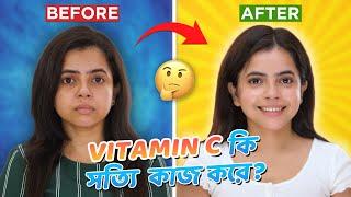 Vitamin C কি সত্যি কাজ করে? | Best Vitamin C Serum for face | Wonder Munna Unplugged