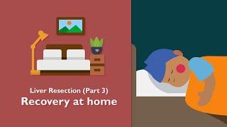 Recovery at Home after Liver Resection Surgery | TVASurg Patient Learning