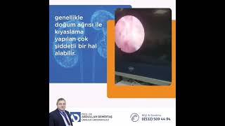 İdrar yolları taş hastalıkları