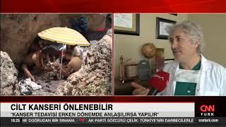 Prof. Dr. Ömer Özkan, cilt kanserindeki artışı CNN Türk'e değerlendirdi