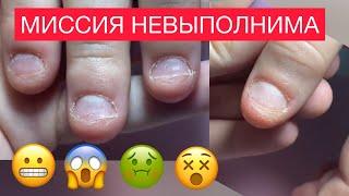 САМЫЕ ОБКУСАННЫЕ  КОРОТКИЕ НОГТИ ГРЫЗУНА  КАК СДЕЛАТЬ  Наращивание миндаль