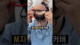 M자탈모 3초 커버 #탈모