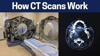 How A CT Scan Works - Principles in Radiology (Computed Tomography)