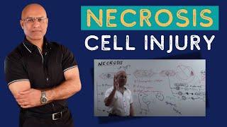 Necrosis Cell Injury | Apoptosis | General Pathology