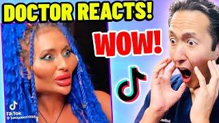 Plastic Surgeon Reacts to BOTCHED Plastic Surgery TikTok Videos!