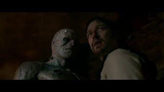 Most creative movie scenes from Victor Frankenstein (2015)