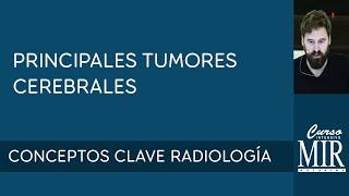 17 Principales tumores cerebrales