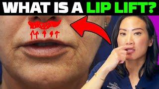 What Is Lip Lift VS Lip Augmentation? (BEFORE AFTER RESULTS)