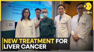 Hong Kong: Researchers claim world's first with liver cancer treatment | Latest News | WION