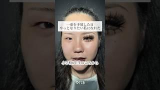 【二重整形】一重を手放した日やっとなりたい私になれた#shorts