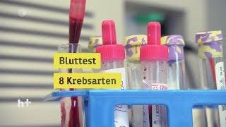 Bluttest soll acht Krebsarten erkennen - heuteplus | ZDF