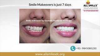 Smile makeover/ Cosmetic dentistry by Dr Trivikram Bangalore.