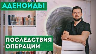 Аденоиды. Какие могут быть последствия если удалить аденоиды ребенку.