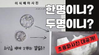 [시험관 둘째 기록] 초음파 보고 왔어요. 착상된 배아는 1개일까? 2개일까? / 양주시 보건소 임산부 등록 /임신출산 바우처 / 국민행복카드