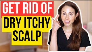 Get Rid Of Dry Itchy Scalp FAST!