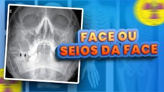 RAIO X DE FACE E SEIOS DA FACE APRENDA SUA DIFERENÇA | Radiologando