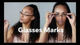 Prevent & Treat Glasses Marks | MassAppealAri