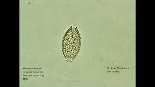 Trichuris trichiura (Intestinal Nematode)- egg