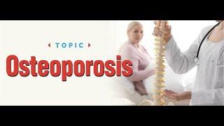 OSTEOPOROSIS