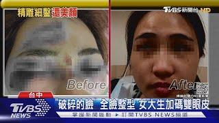 車禍撞成「破碎的臉」女大生 全臉整型手術加碼雙眼皮｜TVBS新聞