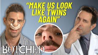 A Botched Nose Job Turned These Identical Twins Fraternal *FULL TRANSFORMATION* | Botched | E!