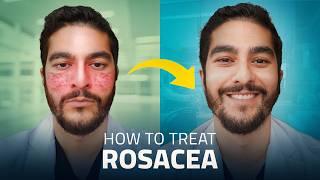 Struggling with Rosacea? Here Are the Best Treatments for 2024