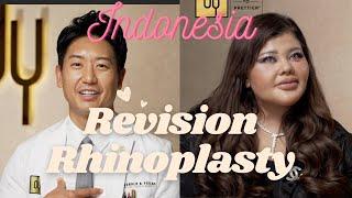 Indonesia to Beverly Hills - Revision Asian Rhinoplasty experience with Shindy (operasi hidung)