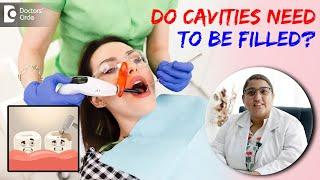 Do I really need to get a Cavity Filled?| Cavity Filling -Dr.Karthika Krishna Kumar| Doctors' Circle