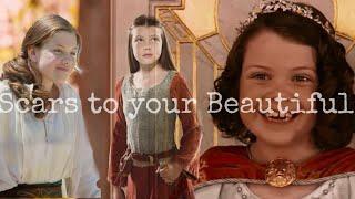 Scars to your Beautiful~Lucy Pevensie