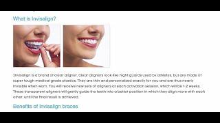 Invisalign Braces London - Forest & Ray - Dentists, Orthodontists, Implant Surgeons