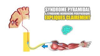  Syndrome pyramidal VS syndrome neurogène peripherique Expliqués Très Clairement par Dr Astuce