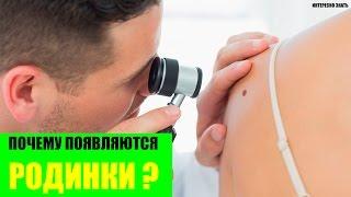 Почему появляются родинки?