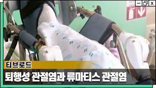 같은 듯 다른 퇴행성 관절염과 류마티스 관절염 [티브로드 방송 - 웰튼병원 송상호 병원장]